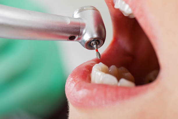 Best Urgent Dental Care for Toothache in Saginaw, TX